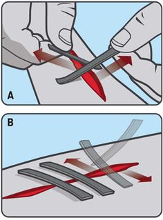 seal wounds with duct tape