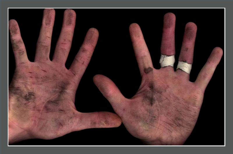 How to Wash Tar Off of Your Hands